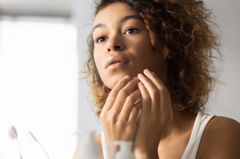 Eliminar manchas de acne en Ribeira